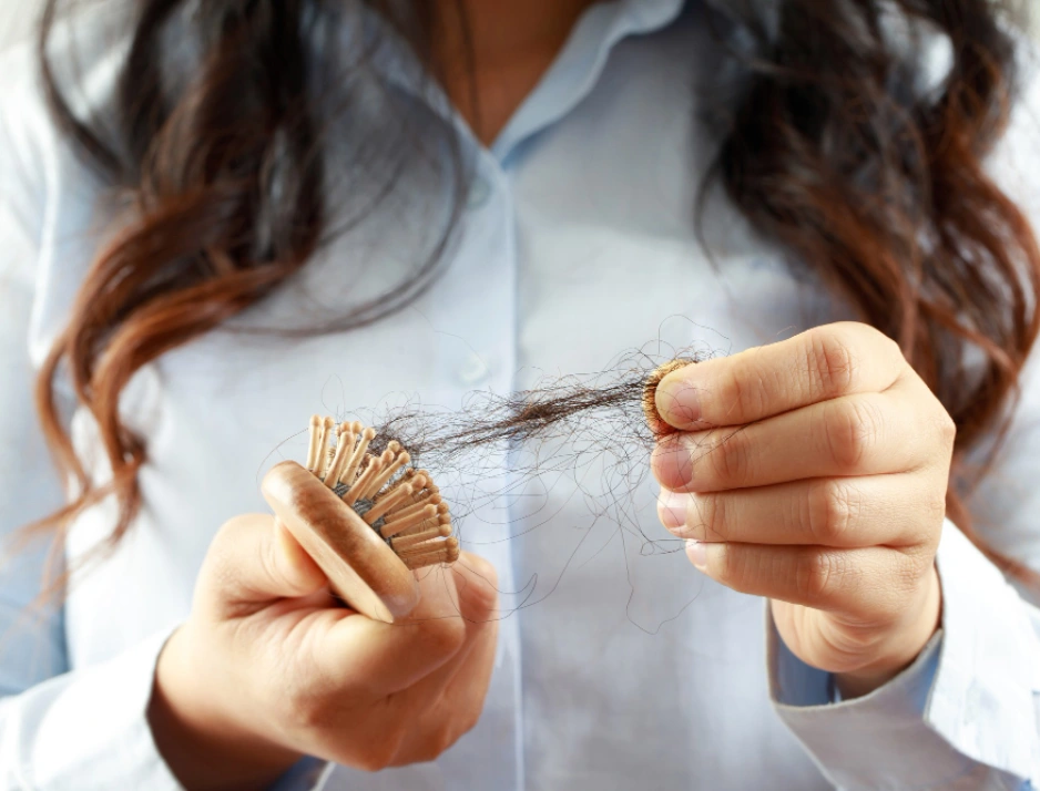 Eine Frau leidet offensichtlich an Haarausfall, da sie eine Bürste mit vielen Haaren darin in der Hand hält.
